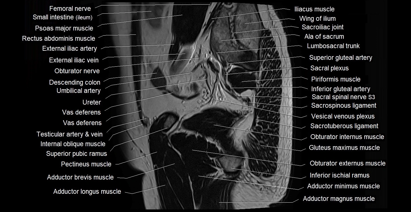 male pelvis sagittal cross sectional anatomy 3T mri image 11.webp